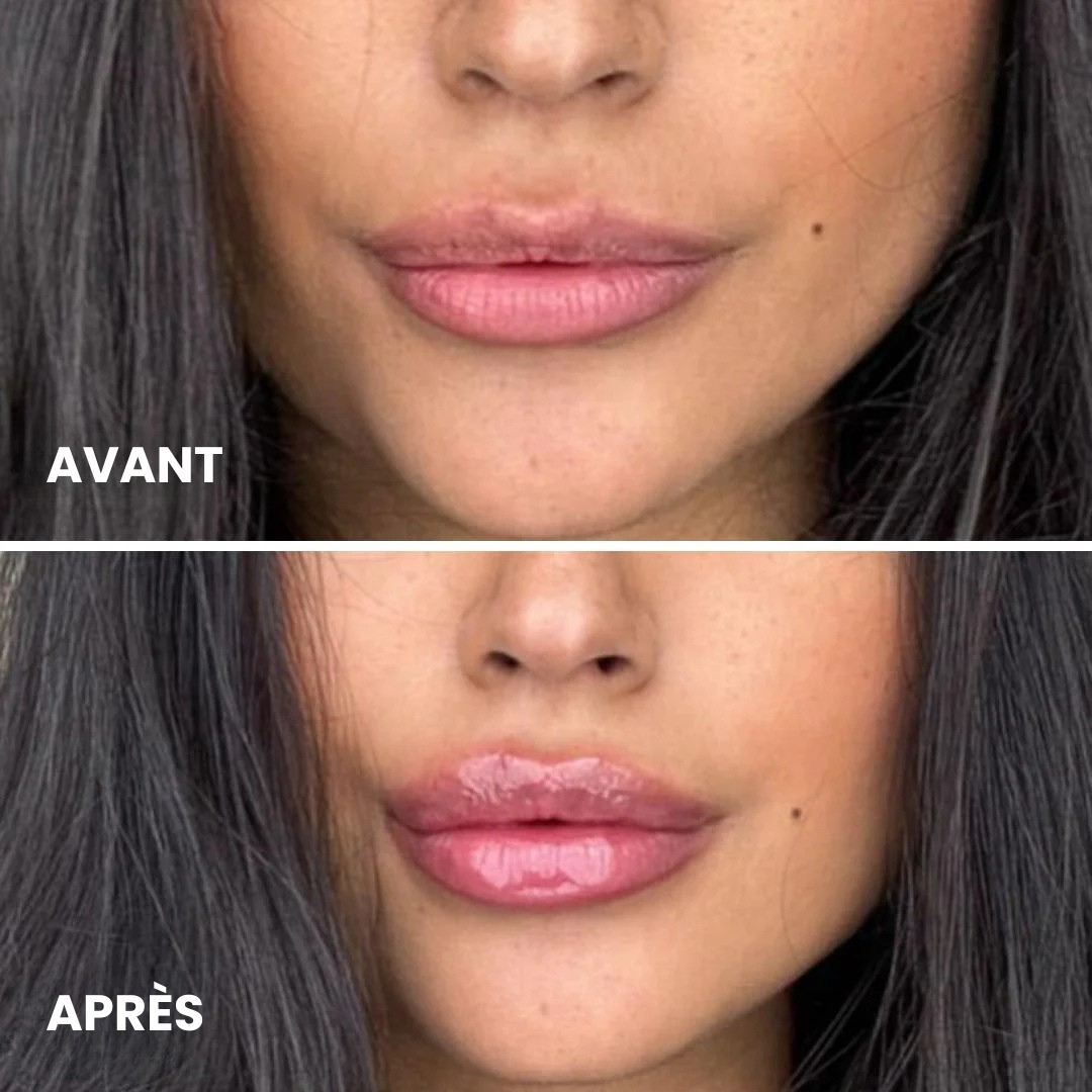 Eclatt Lèvres Repulpeur